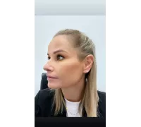 Zlaté náušnice 3944