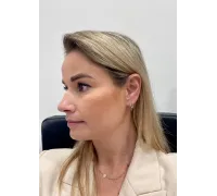 Zlaté náušnice 4413