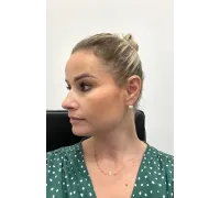 Zlaté náušnice 4173