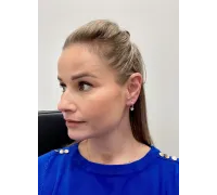 Náušnice z bieleho zlata 1576